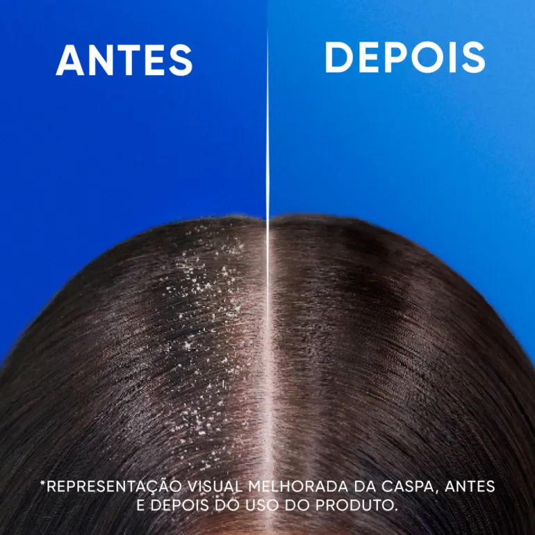 Champô Anticaspa Mentol Fresh