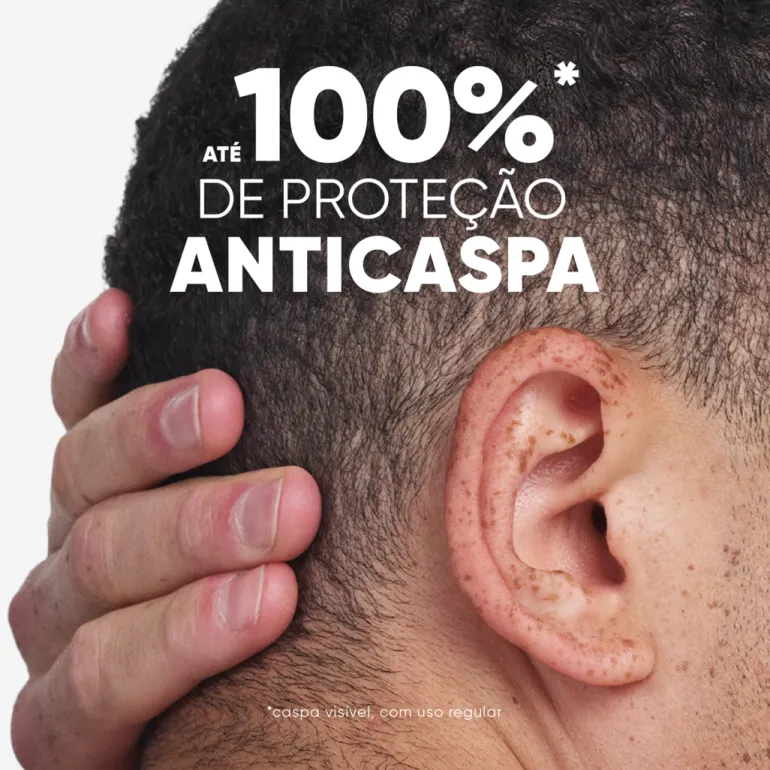 Champô Anticaspa Mentol Fresh