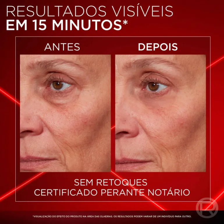 Creme de Olhos Corretor Revitalift Laser
